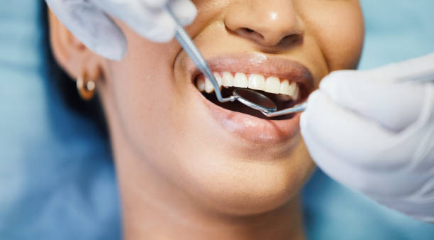 Best Teeth Whitening  in Captain Cook, HI